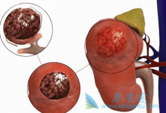 ��̹/��������������ӳ�������������DFS����λ����ʱ��