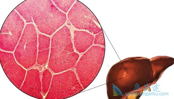 舒尼替尼 舒尼替尼