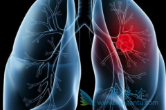 �ΰ�����֢״������Щ֢״�Ƿǳ�������