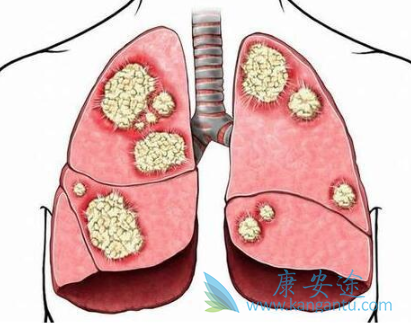 �ΰ������ܻ���