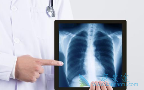 肺癌晚期症状 肺癌晚期症状