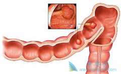 ����������������������������ֱ��������Ч����ô��