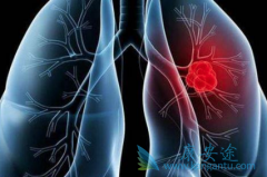 �ļ���ΰ����ڵ�֢״��Ҫ����ע��