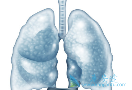 肺癌晚期死前症状 肺癌晚期死前症状
