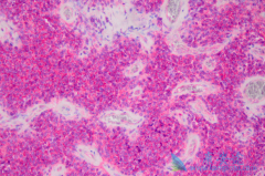 �������ὺ�����������ڷ�������ʹ�����޽�չ�������ӳ�1��