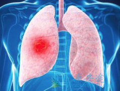 �ΰ�������ô�����Ƿΰ����������ĵ�����