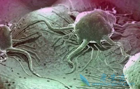 �ΰ�������ʳ