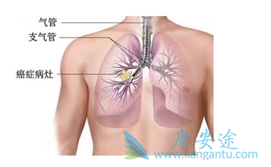 �ΰ����ڻᴫȾ��