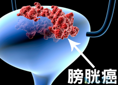 ���ᵥ��(Panitumumab)���ư��װ�Ϊʲô������Ѫ��