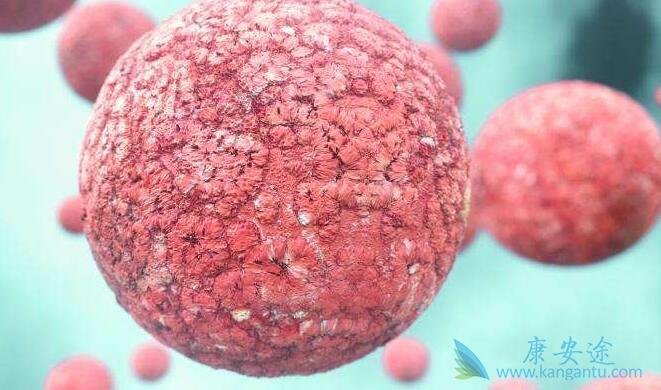 非霍奇金淋巴瘤 非霍奇金淋巴瘤