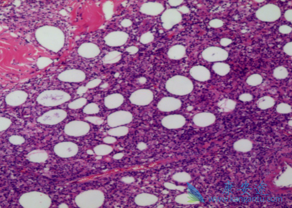 本妥昔单抗 本妥昔单抗