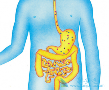 ������(STIVARGA)���������е�θ����������������