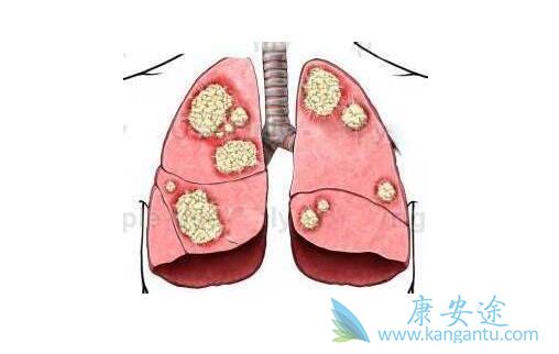 ��Сϸ���ΰ�