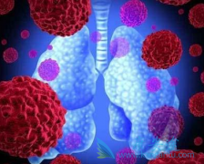 ��������/����ɳ��Ч��ͨ��֢״��û���ƺ������Ƿ���С�������ж�