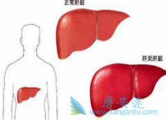 �˽�ʲô�Ǳ����Լ������ٴ�֢״����Ҫ