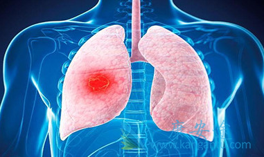 印度特罗凯 印度特罗凯