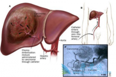 ������ʲô���������ܻ���������Щ����Ӱ��