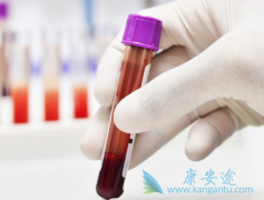 �Ҹα��濹ԭЯ������Ҫע����Щ��