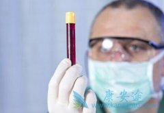 �Ҹα��濹�����Ժ�������ʲô����