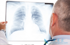 �ΰ����������ڷΰ���ת�ƻ��ߵ����ƻ�ʯ