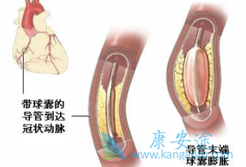 1532316286422658.png image.png