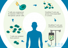 ���Ͱ�֢�������Ʒ���CARTϸ���Ʒ�����һ����ȱ��