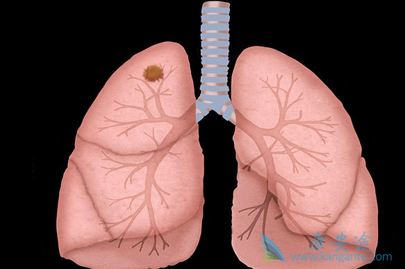 �ΰ�����