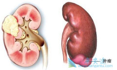 ��������/��̹��Ԥ���������󸴷�����Чҩ����