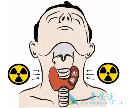 甲状腺癌症 甲状腺癌症