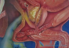 �������׻���ǰ���ٰ�֢״����Щ��Ҫ��������