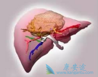 瑞格菲尼 瑞格菲尼