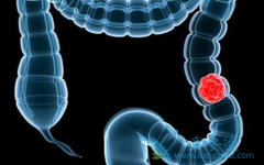 ת���Խ�ֱ�������߷��ð����(REGONIX)�������Щ������Ӧ