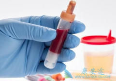 ����Ѫ��ͻ�����ȷ���ǰ��װ�֢״