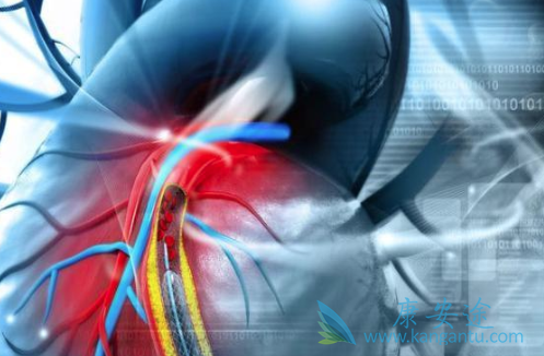 心脏支架手术后注意事项 心脏支架手术后注意事项