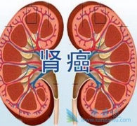 �ҹ���̹/���������ٴ��о������PFS���������������