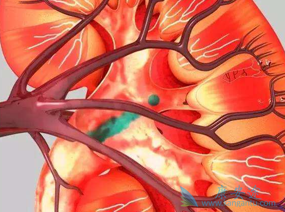 舒尼替尼 舒尼替尼