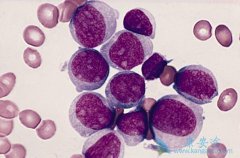 ��Ѫ����ô�Σ���Ѫ������Щ���Ʒ�����