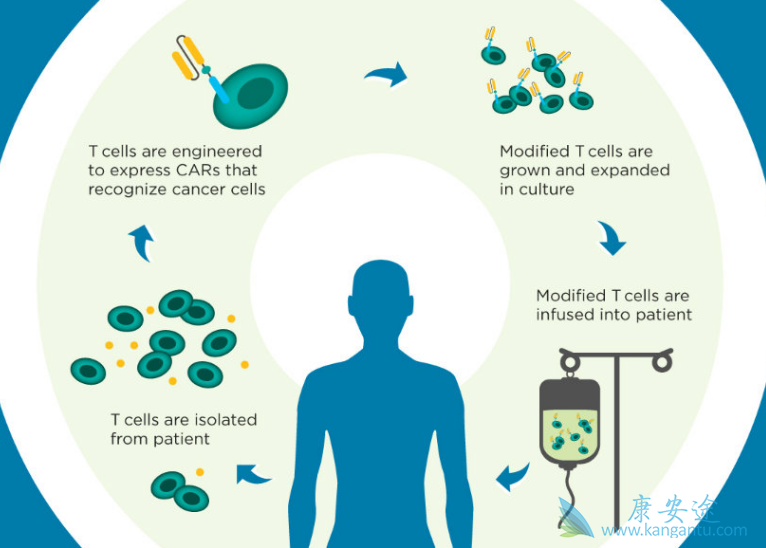 CAR-T细胞疗法 CAR-T细胞疗法