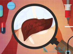 ���Ա��ο������ƺ��𣿱������ƺ�Ҫע��ʲô���