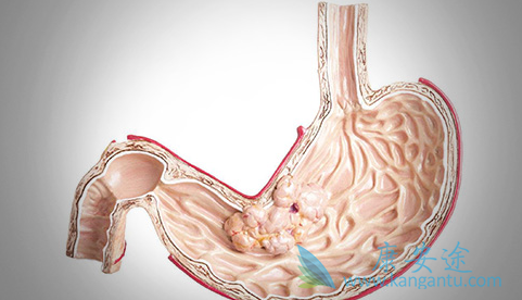 ��ɳ����