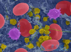 ��ɳ��(Eloxatin)��������ϸ���ܰ�������ѡ����ҩ��