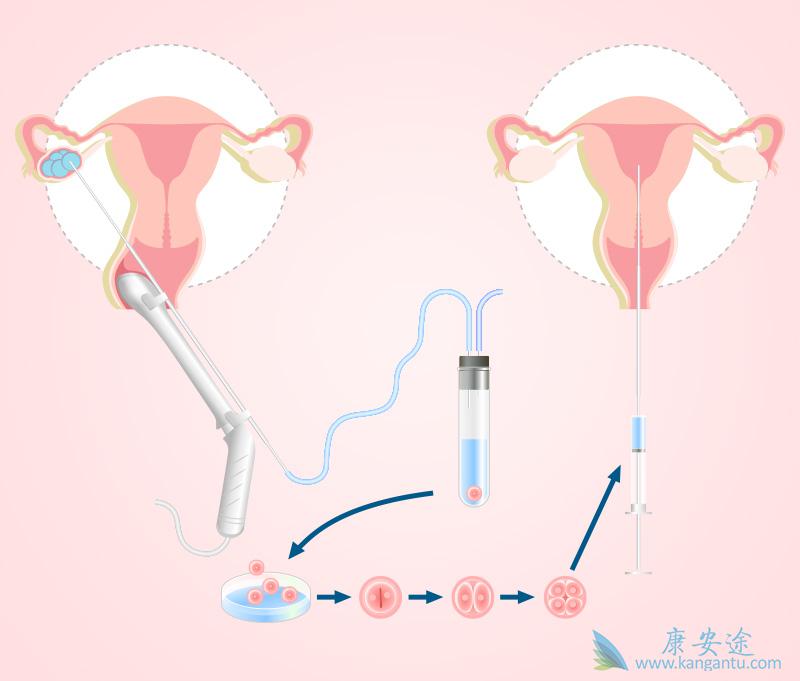 泰国试管婴儿医院 泰国试管婴儿医院