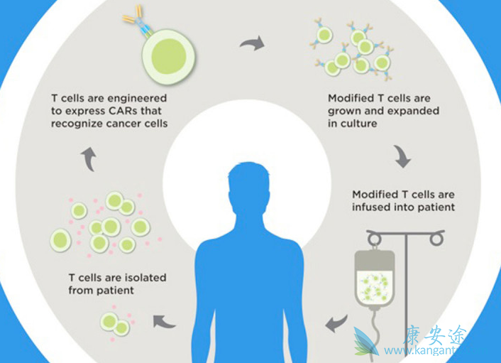 CAR-T治疗 CAR-T治疗