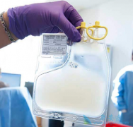 CAR-T�Ʒ����˿�������ѪҺ�����⻹����ЩӦ��