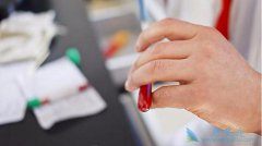 ʲô������Ҹκ��Ŀ���������Ҫ���߸���ע��