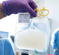 ��CD19Ϊ�е��CAR-Tϸ��������Ŀǰ��Ҫ���о��ȵ�