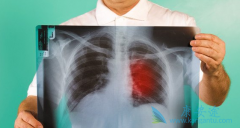 ��Ȭ��(Keytruda)���ϻ���ʹ���ڷΰ����ߵ��������ս�����51%