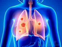 ��������(sutent)��ʹСϸ���ΰ������޲������ڵõ�����