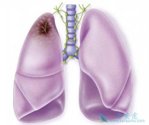 ԭ���Էΰ���ת���Էΰ��ļ��𷽷�