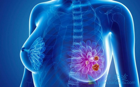 拉帕替尼 拉帕替尼